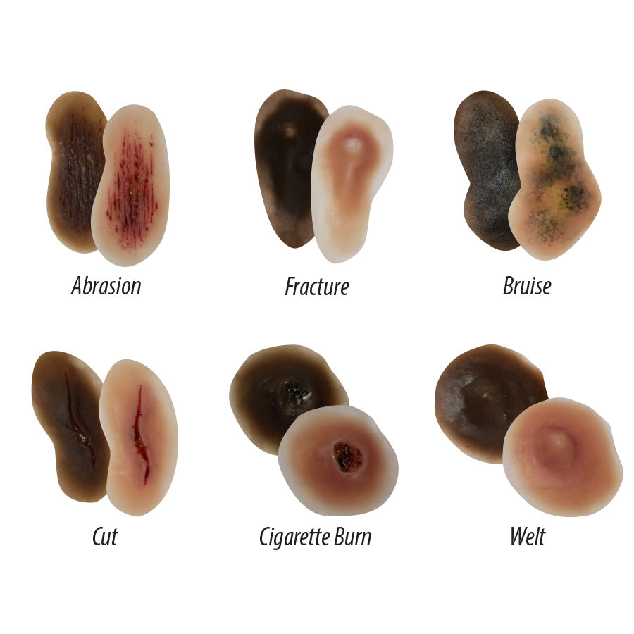 Child Abuse and Neglect Training Kit