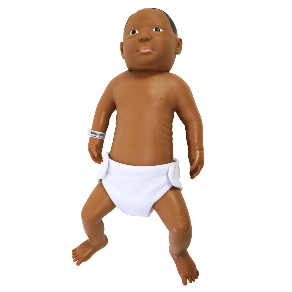 Down Syndrome Baby