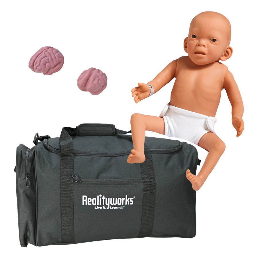 Fetal Alcohol Syndrome Baby