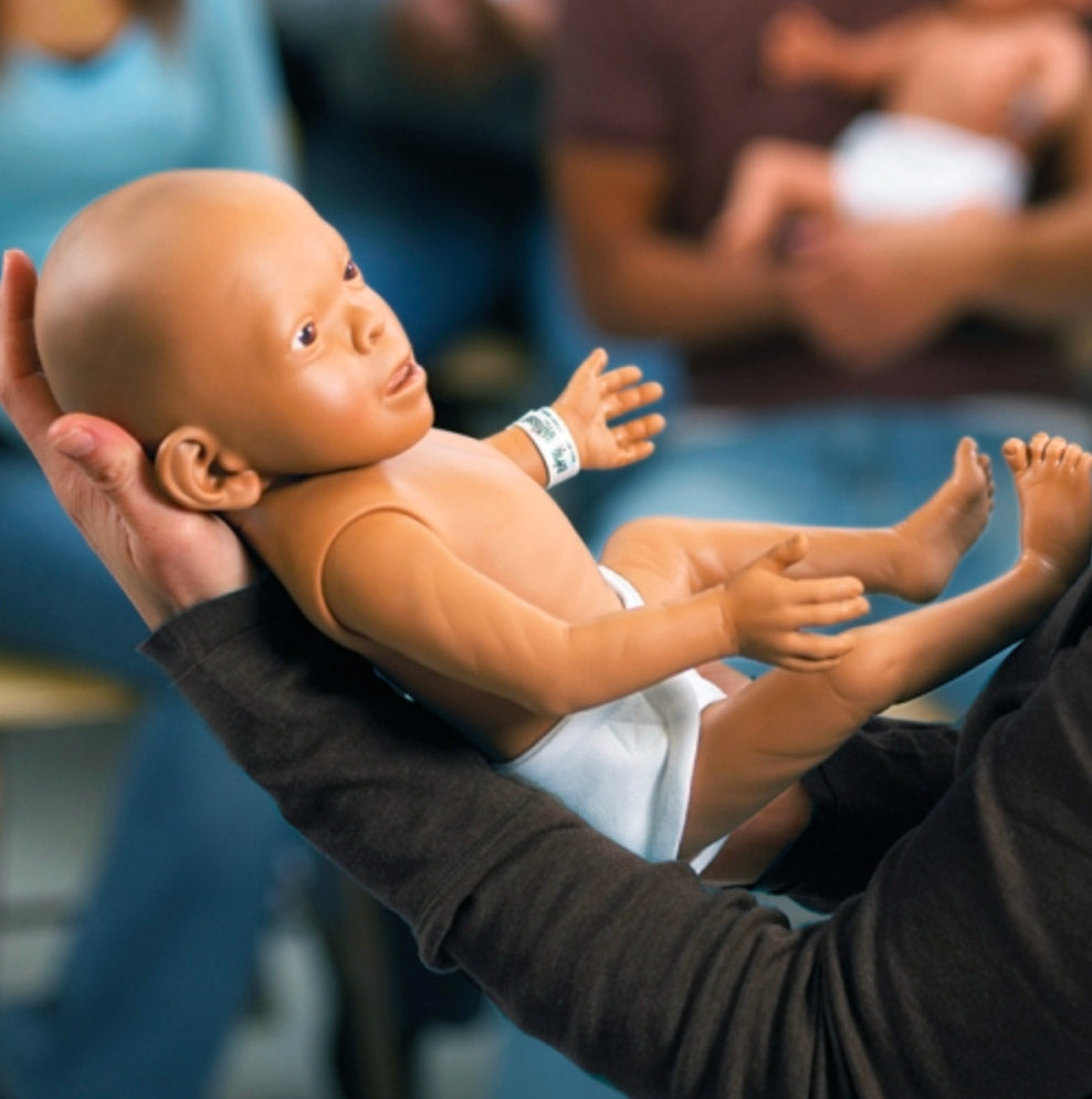 Fetal Alcohol Syndrome Baby