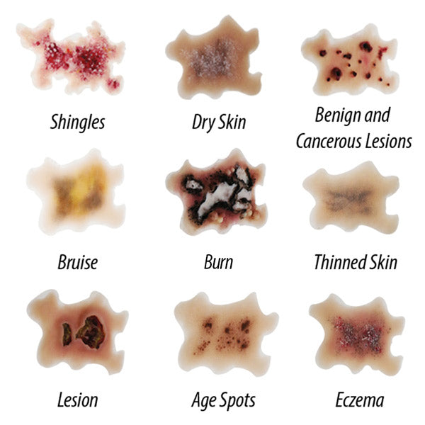 Geriatric Skin Conditions Simulation Set (9 skin conditions)