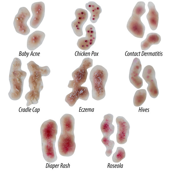 Infant Skin Conditions Kit